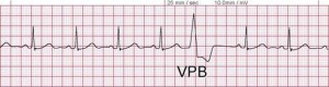 VPB