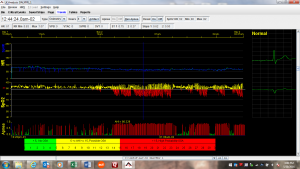 ECG