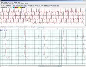 LX AnalysisPage